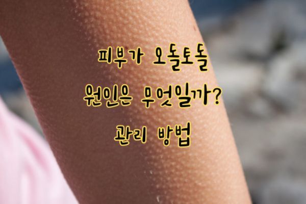 피부 오돌토돌 가려움 원인 치료