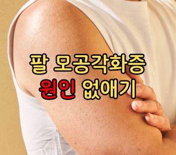 팔 모공각화증 원인 없애기